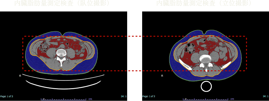 内臓脂肪量測定検査（臥位撮影）、内臓脂肪量測定検査（立位撮影）の画像