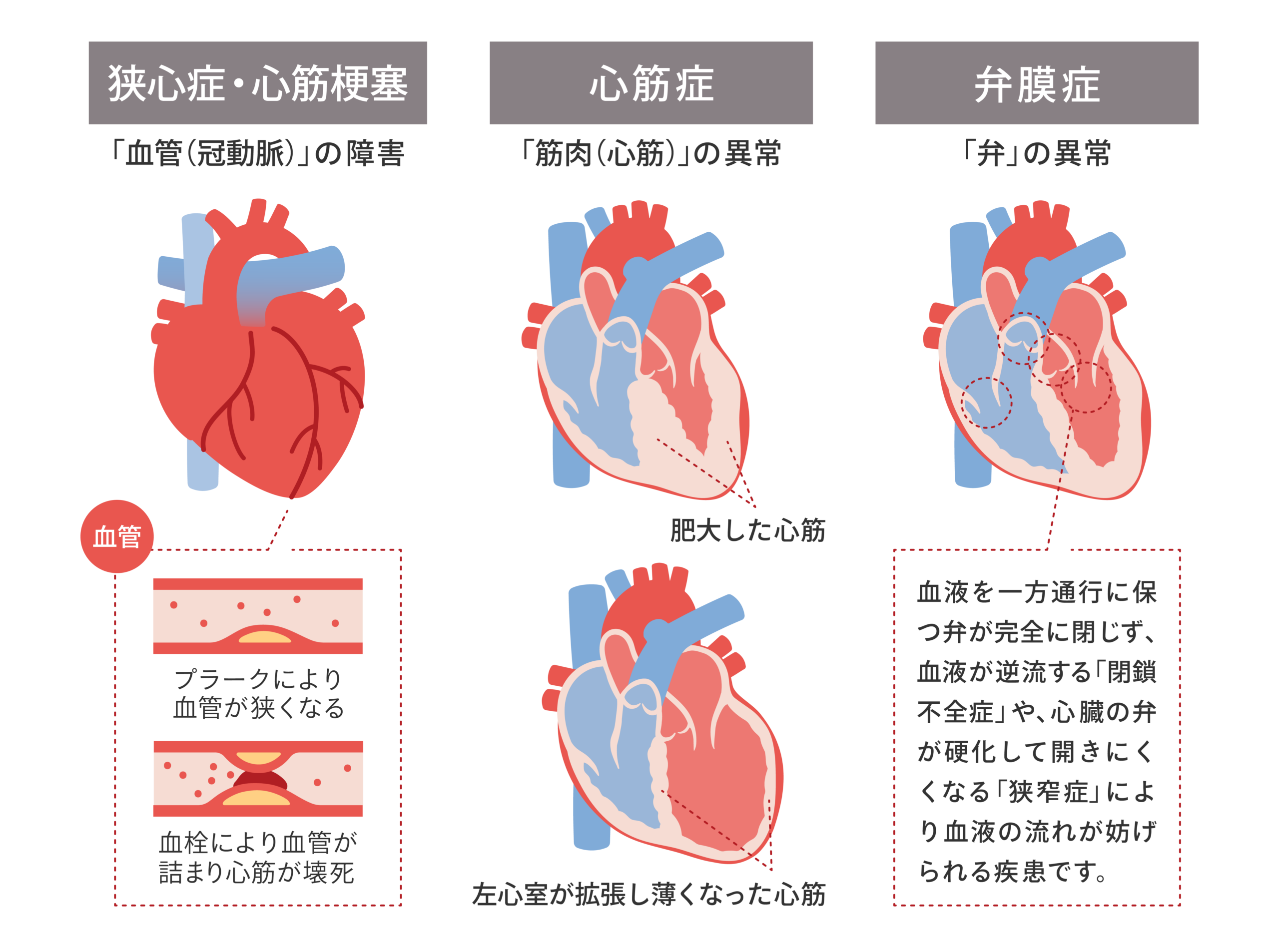 心臓ドックで分かる疾患